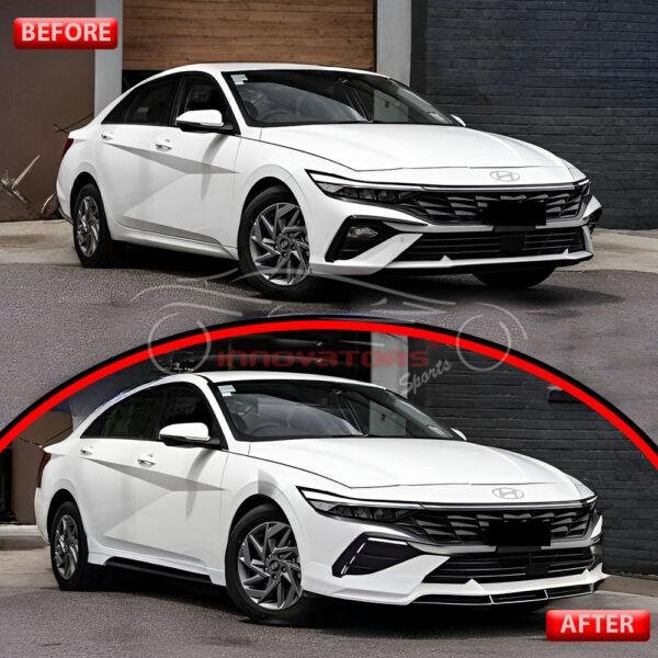 Hyundai Elantra Hybrid Latest Body Kit 2025